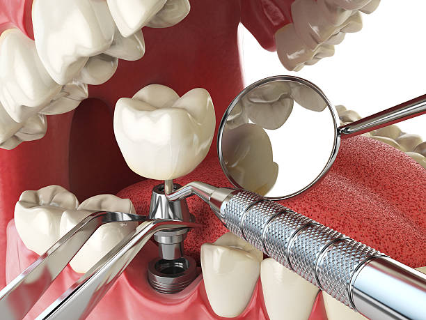 Best Urgent Tooth Repair  in , MO